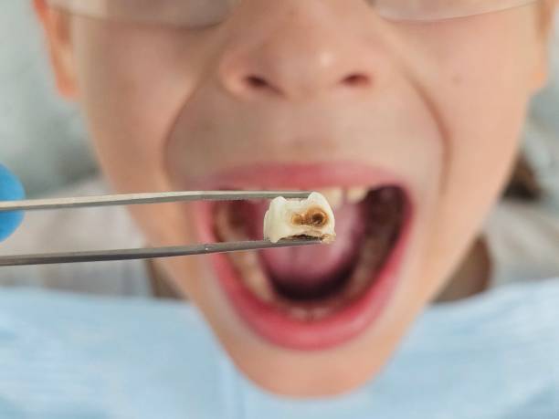 Best Pediatric Emergency Dentist in Kent Estates, IA