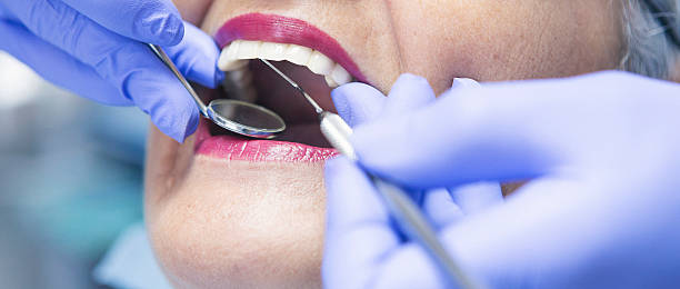 Best Emergency Dentist for Lost Fillings or Crowns in Kent Estates, IA